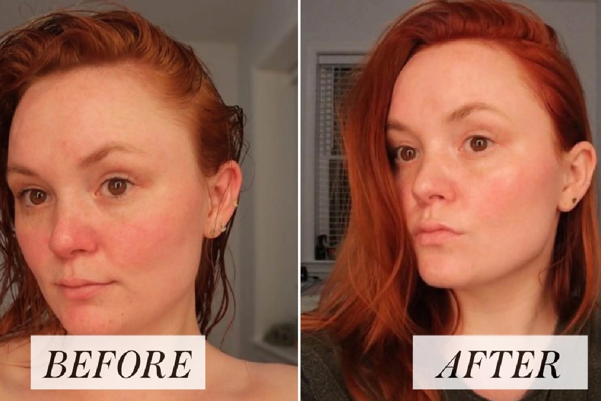 تصویر فردی قبل و بعد از استفاده از ماسک صورت خانگی برای از بین بردن چین و چروک و جلوگیری از پیری پوست